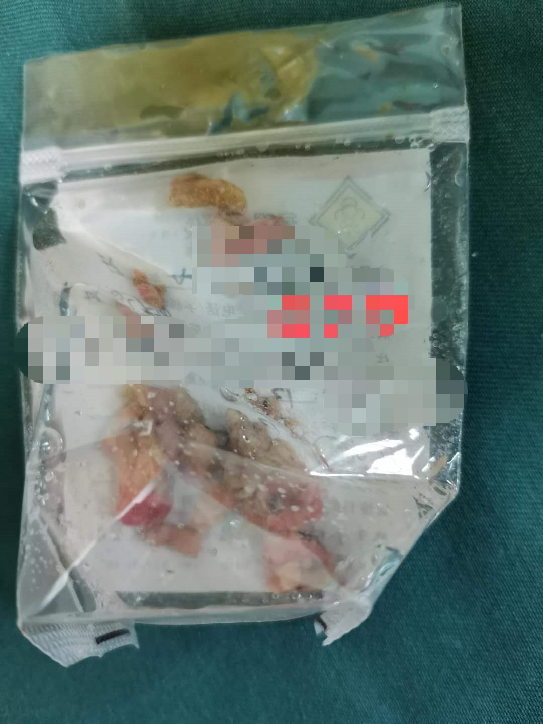 备孕日记:我在复兴医院做子宫内膜手术的日记