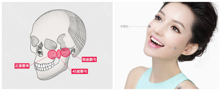 改善颧骨的10个方法,颧骨美学