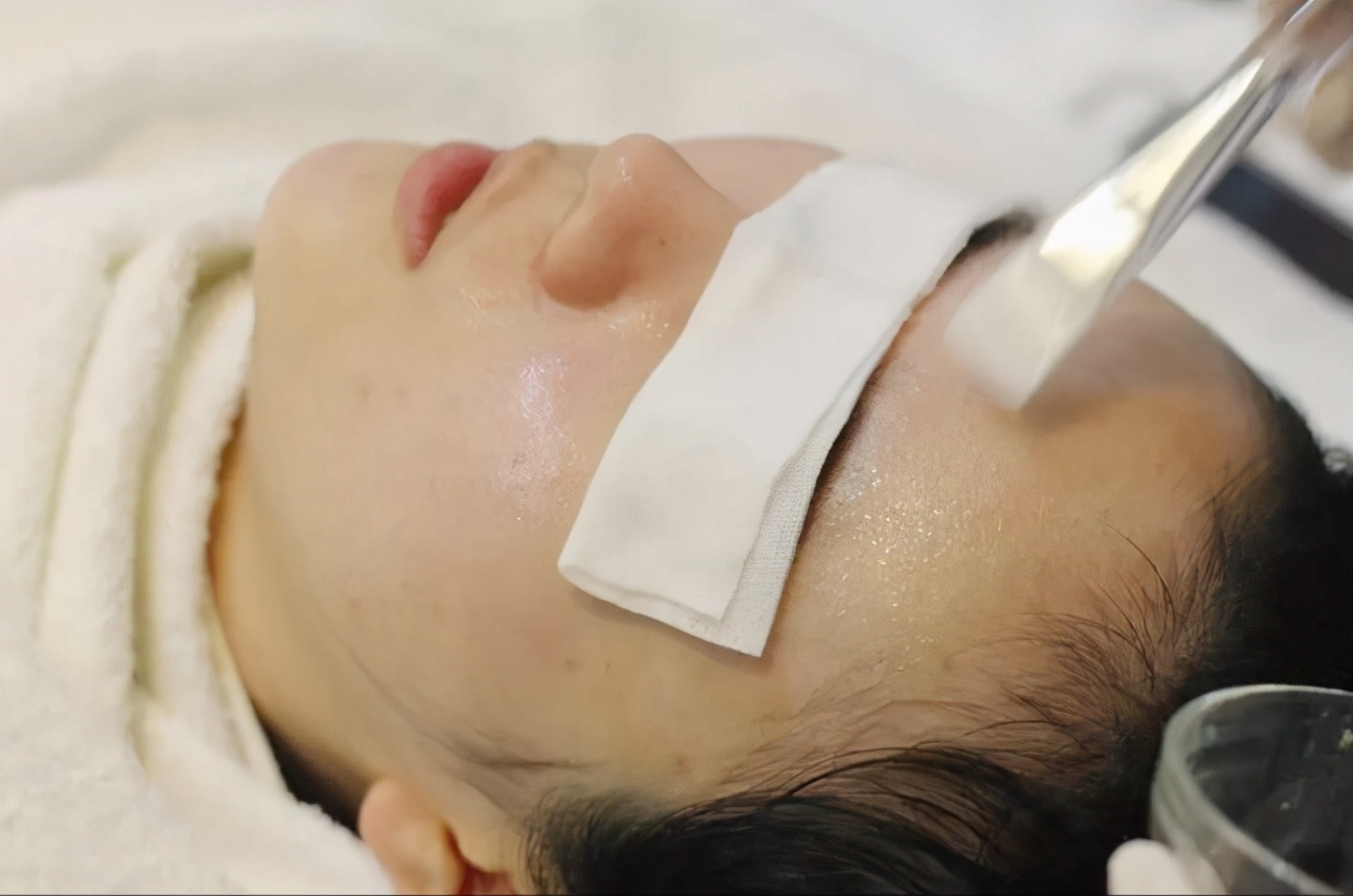 痘肌必看果酸换肤详细指南,果酸换肤对治疗痘痘作用大吗