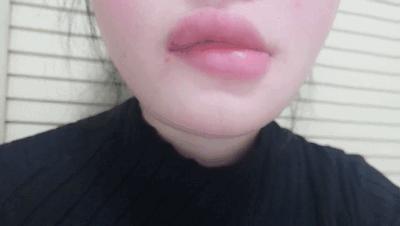 整容改脸型多少钱,女子花3万5整形结果