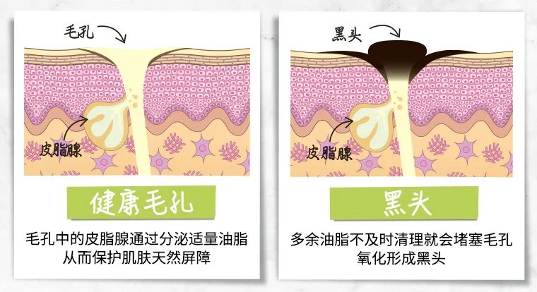 科颜氏白泥优惠价,科颜氏白泥正确使用方法时间