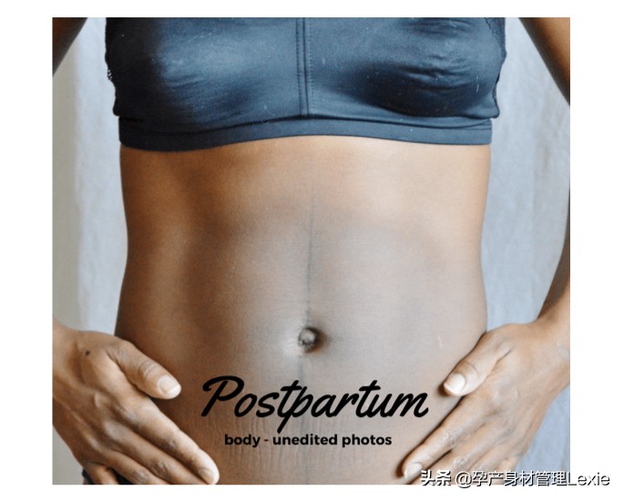 产后腹直肌分离怎么瘦肚子,产后腹直肌分离肚子松松垮垮