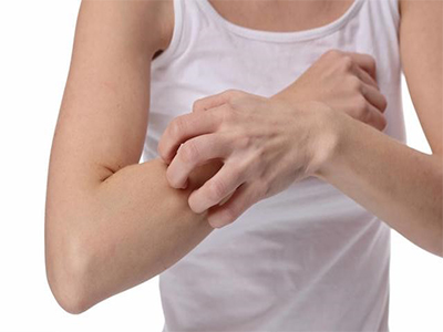 皮肤过敏原因及解决方法,皮肤过敏是什么原因造成怎么办