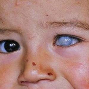 喜好咖啡的朋友注意!头一次听说“咖啡毁眼”?这是真的吗?