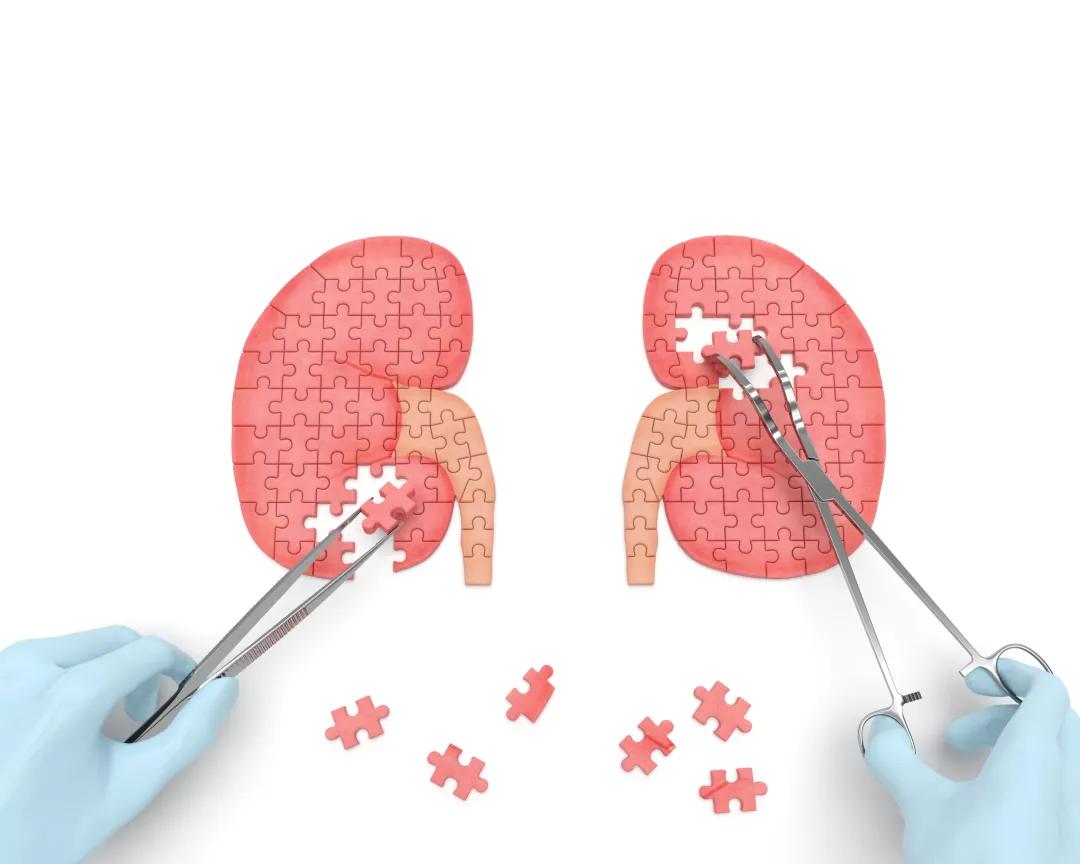 华西耳鸣专家郑芸在哪里坐诊,华西郑芸耳鸣治疗方法