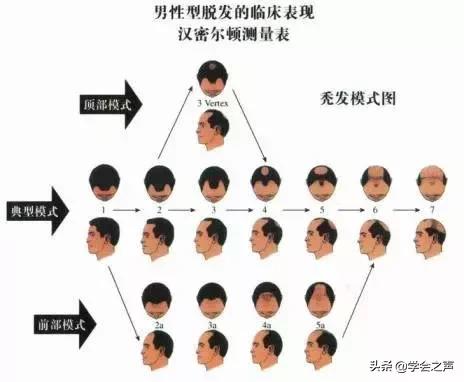 亲测有效的防脱发小技巧,脱发严重这个防脱发妙招很好用