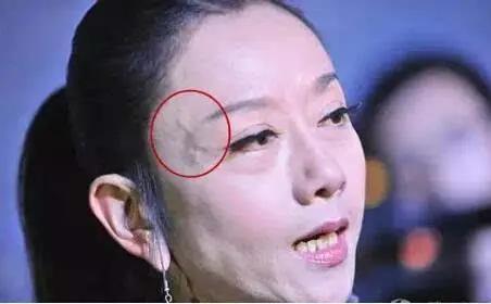 青筋明显说明肝脏出了大问题,青筋暴起的病