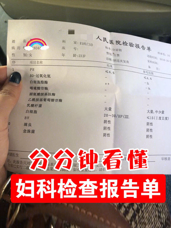 检验科医生分分钟教你看懂妇科检查报告单！