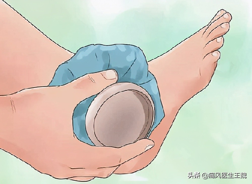 痛风为何根治不了,血尿酸与痛风十大误区你了解多少