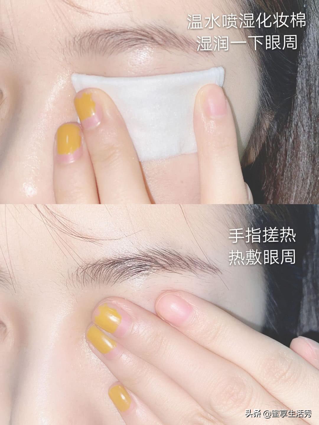 内双眼皮怎么变外双按摩最有效,内双眼皮手术变外双效果