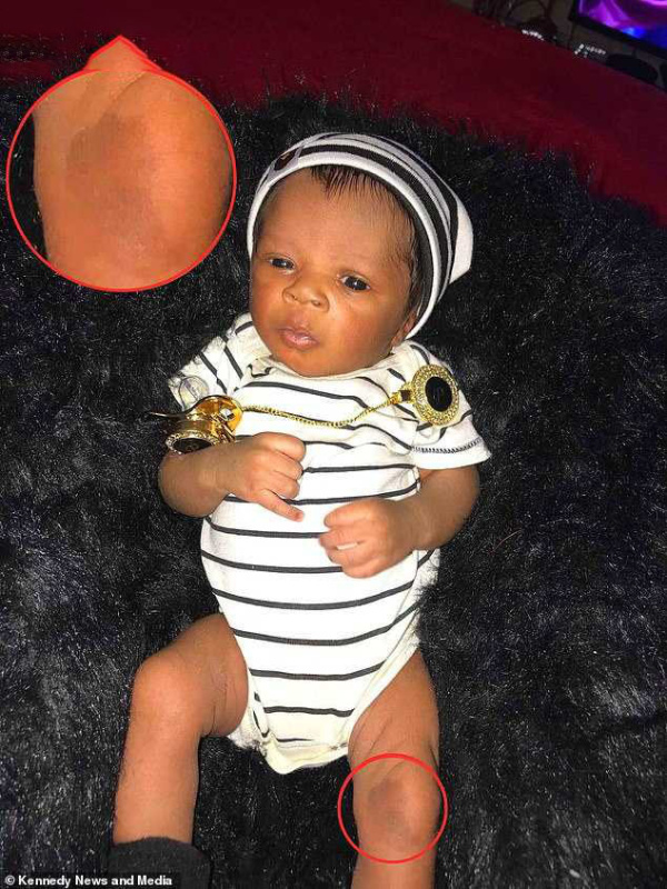 最美胎记小女孩,最美胎记女孩子