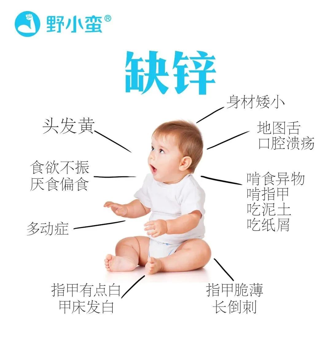 野小蛮锌硒宝,野小蛮锌硒宝压片糖果