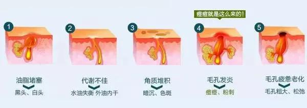 日式洗澡神器搓澡刷,日本变态搓澡巾