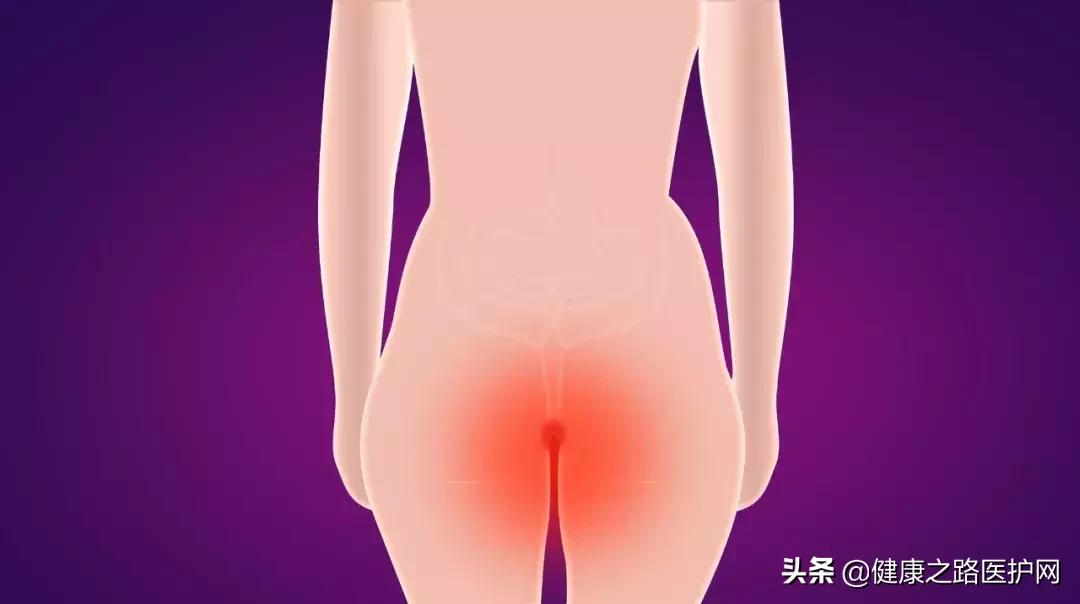 医生说痔疮不是急症是什么意思,医生说痔疮发炎