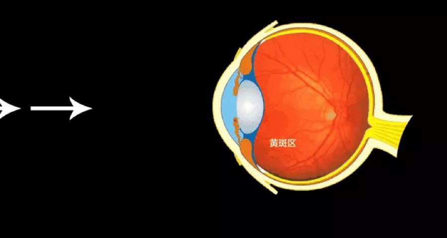 蓝光眼镜真相大揭秘,315揭秘蓝光眼镜