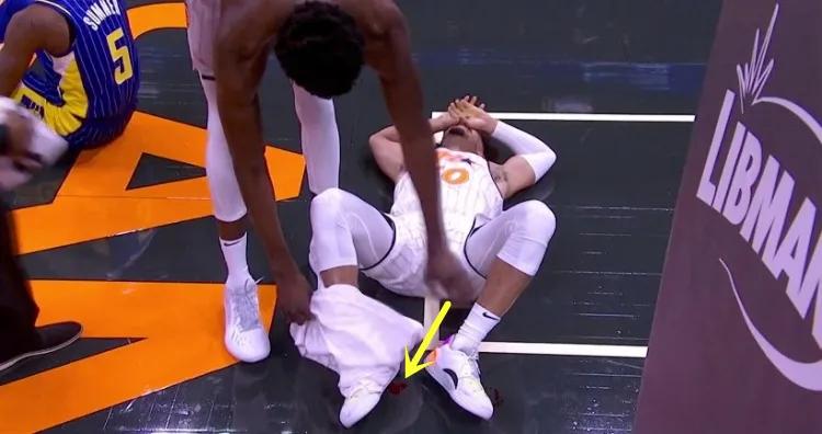 nba球员开放性骨折最后怎么样了,为什么nba球员脚踝受伤还能继续打