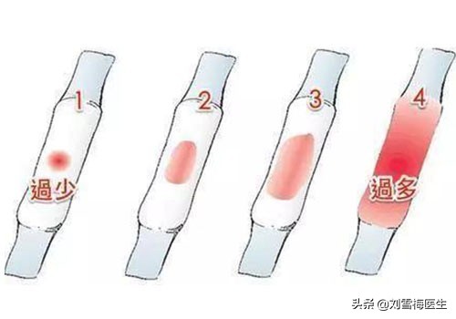 月经少是卵巢早衰老得快吗,月经量特别少是卵巢早衰吗