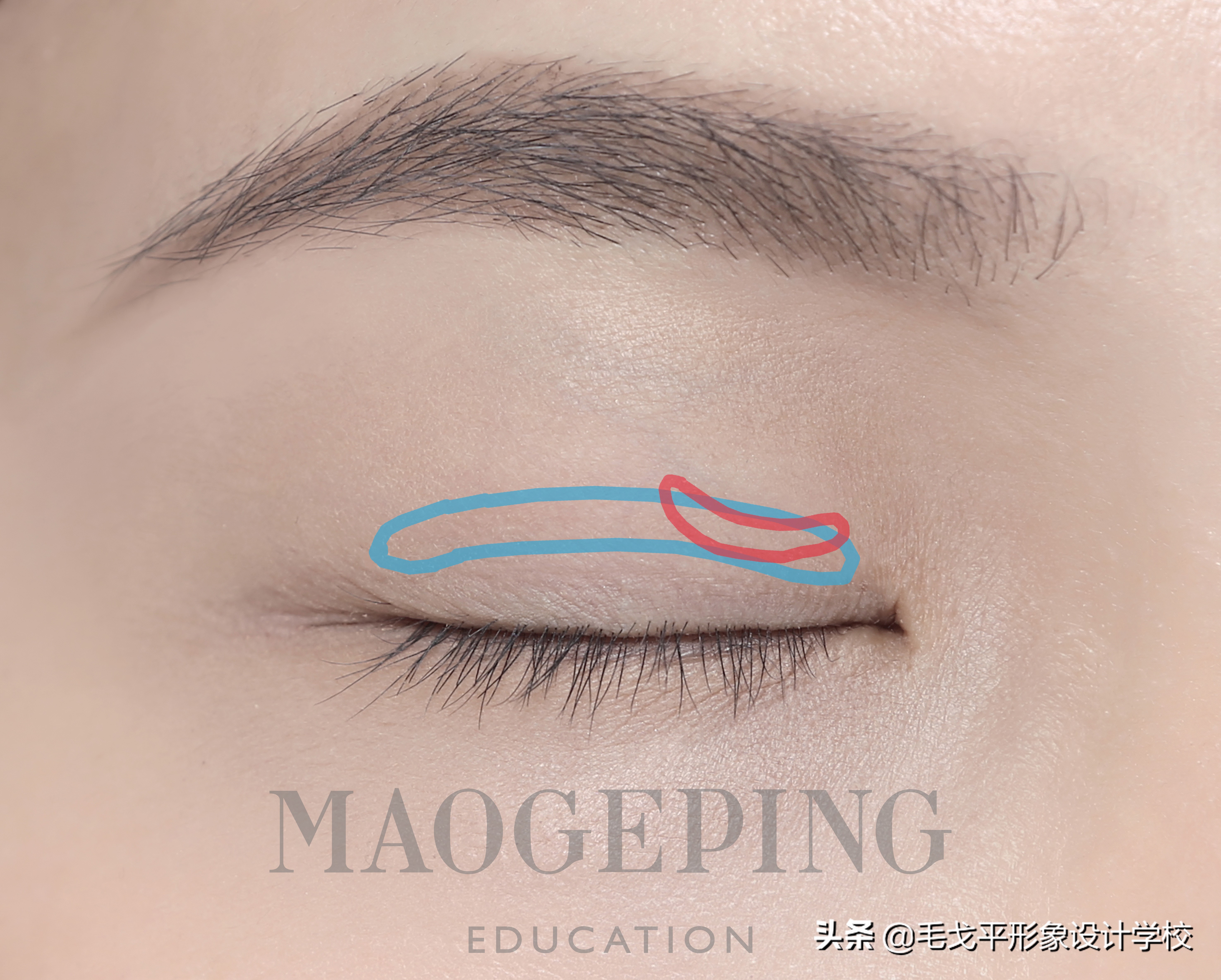 单眼皮肿眼泡正确贴法教程,单眼皮肿眼泡怎么贴双眼皮