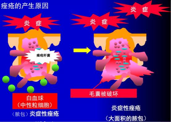 浠欎汉鎺岀棙鑲屼慨鎶よ啅,鐪嬪畬鐥樼棙浠ュ悗鎰熻鏇翠弗閲嶄簡