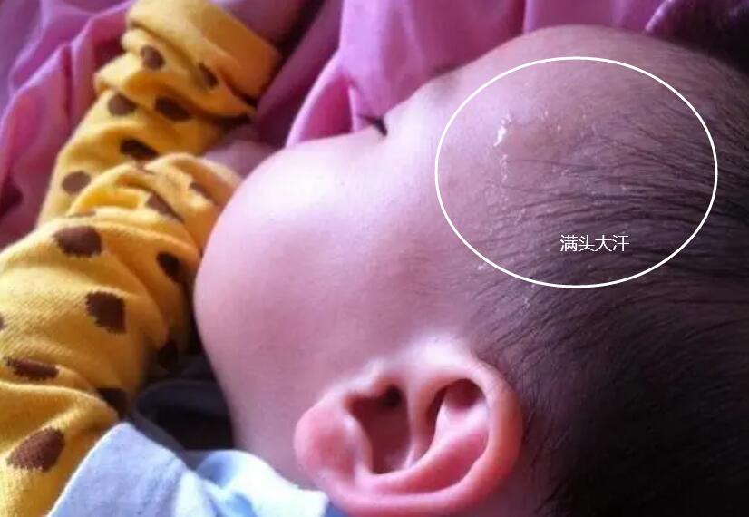 孩子一睡觉就出汗，别总以为是缺钙！父母记住3个“关键词”