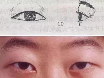 做好这五件事延迟寿命7年,十天内怎么消除肿眼泡