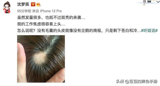 脑门大发际线高的女明星,大脸大脑门秃头女生适合的发型