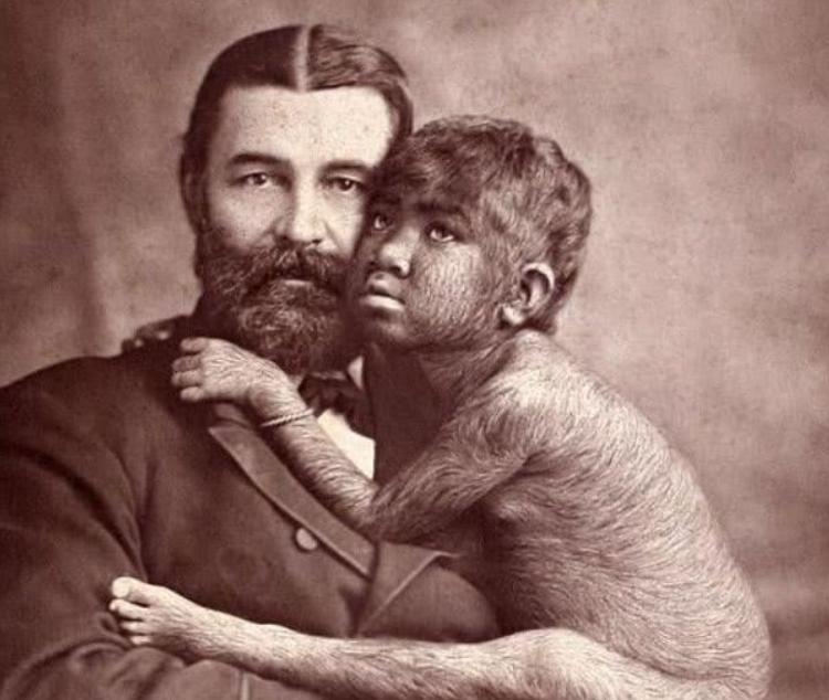 探险家活捉野人女孩完整版,欧洲野人女孩临终遗言