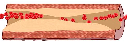 鍗疯¥鑴氶湶琚滆鏁欏,绉嬪啲鍗疯¥鑵块湶鑴氳笣