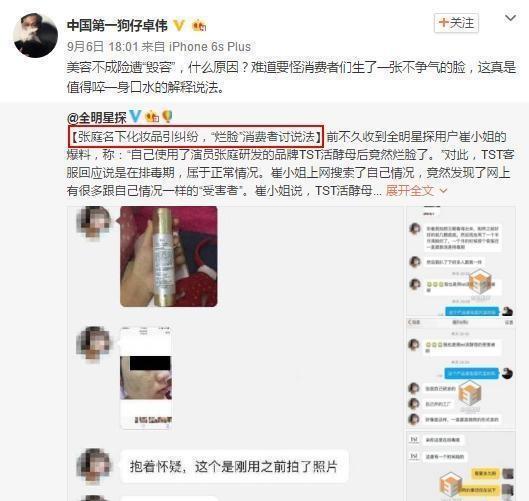 极限挑战张庭代言的产品,张庭微商极限挑战