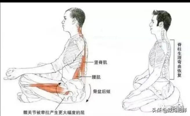 驼背不改正会越来越驼吗,为什么会驼背驼得很厉害