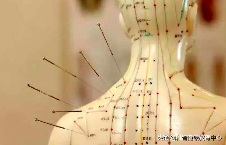 国际权威医学期刊发文：针刺能改善功能性消化不良症状