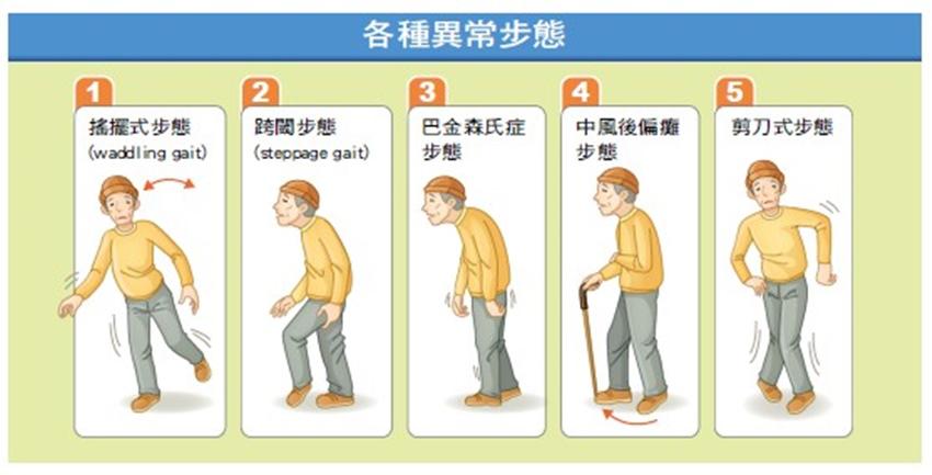 什么是正确的姿势？论姿势的重要性以及老化与姿势之间的关系！