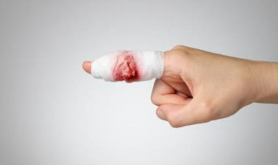 一男孩被公鸡抓伤脸部长出鸡爪,小孩被公鸡抓伤了会不会留疤