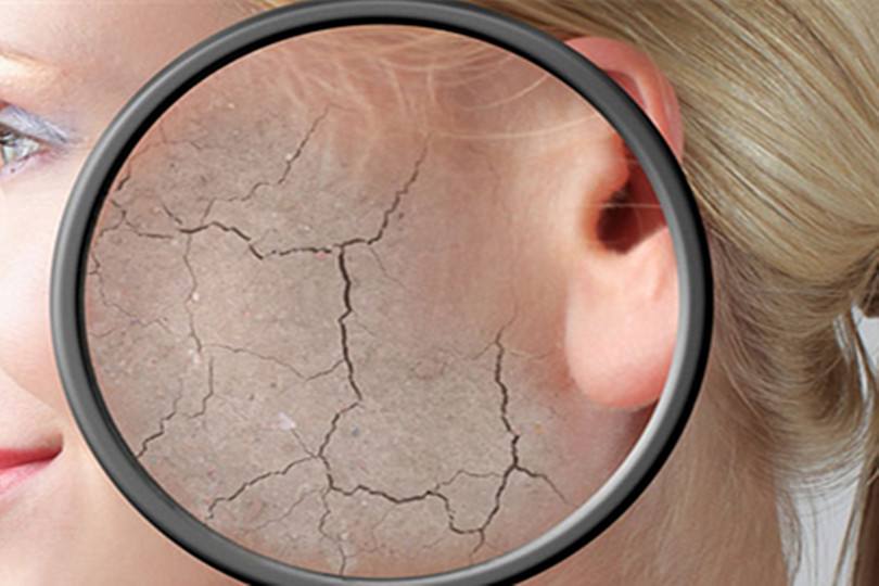 冬天混油泛红起皮敏感用什么面膜,秋天用水乳还是用面膜呢