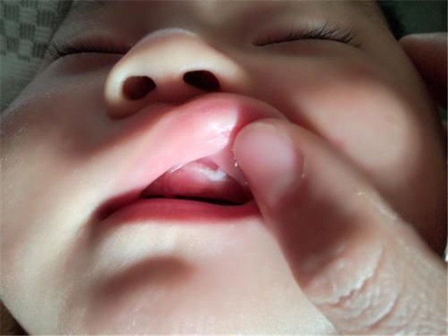 安抚奶嘴需要选择大小号吗,安抚奶嘴需要和奶瓶奶嘴一样嘛