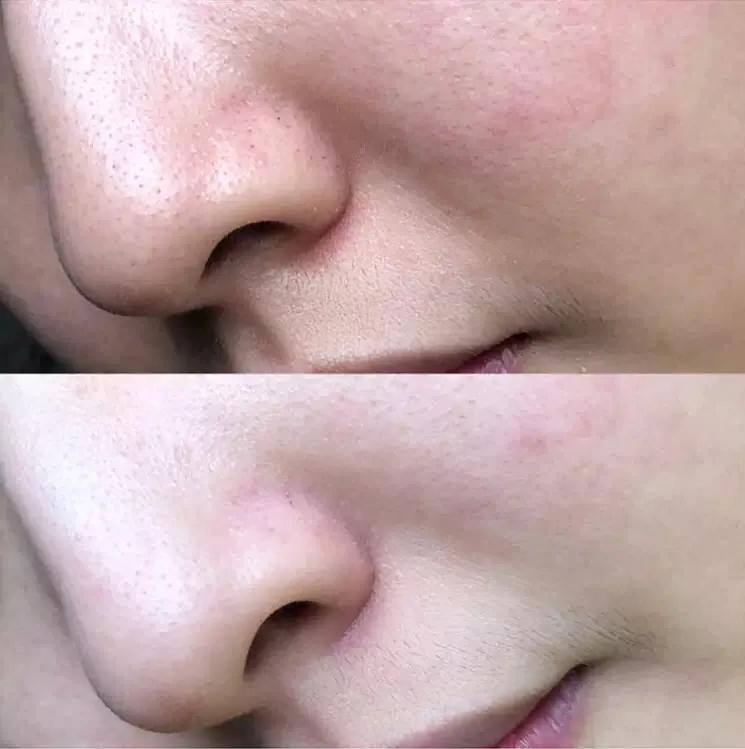 扒一扒护肤品,科颜氏白泥清洁面膜真实测评