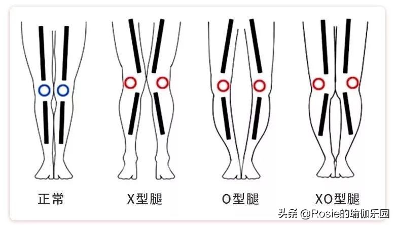 如何从大粗腿瘦成筷子腿,胖粗腿怎么瘦成漫画腿