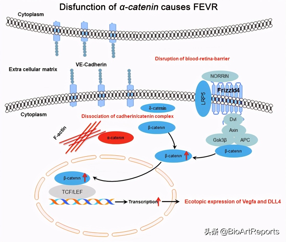 家族性视网膜病变是怎么回事,基因治疗视网膜病变最新进展