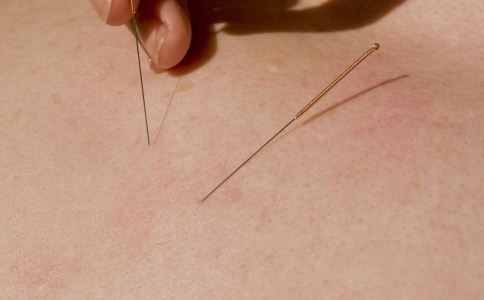 针灸各种疾病对应穴位,精神类疾病能针灸治疗吗