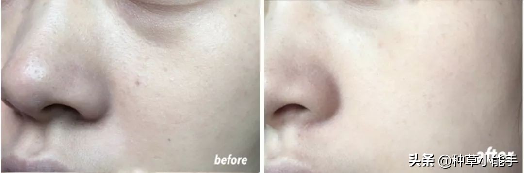 一抹磨皮棒,一抹磨皮