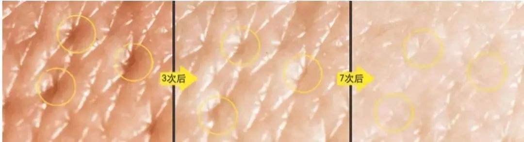 杨颖蔡徐坤cp高甜奔跑吧第十季,奔跑吧第4季蔡徐坤和杨颖cp