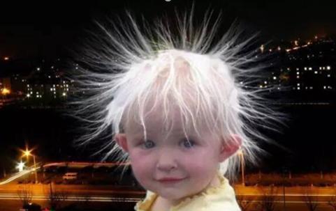 6岁小孩为什么有少白头,孩子有几根白头发算少白头吗