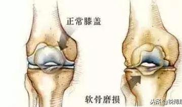 肉牛关节肿大怎么办,牛常见病辨认和治疗方法