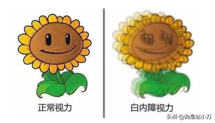 年轻人体检发现白内障怎么办,年轻人白内障如何自我调理