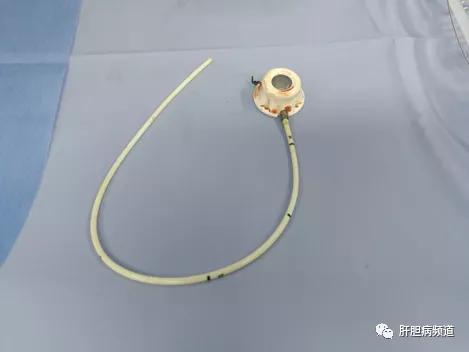 晚期胃癌转移卵巢怎么办,晚期胃癌转移肝有必要治疗么