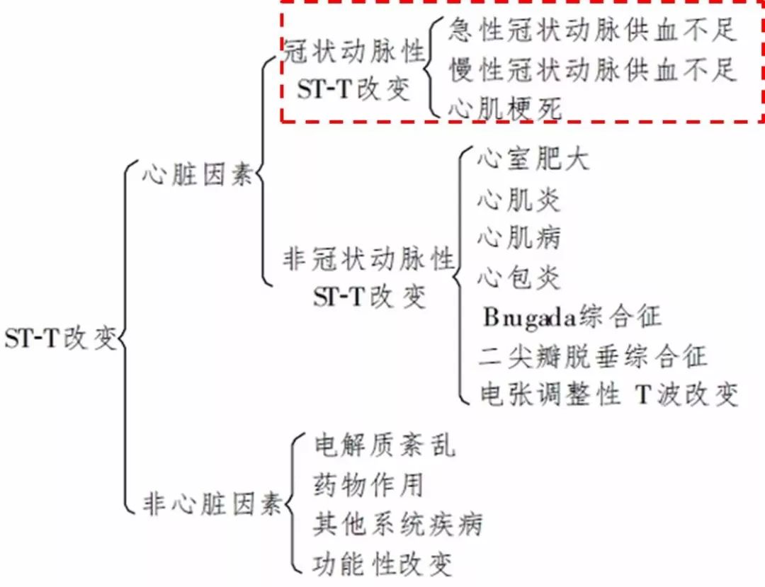 心律失常55分钟讲解,心律失常心电图讲解视频教程全集
