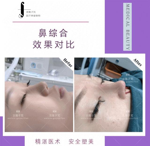 814元人气精华护理免费做！一次就焕颜新生！聚会女王就是你