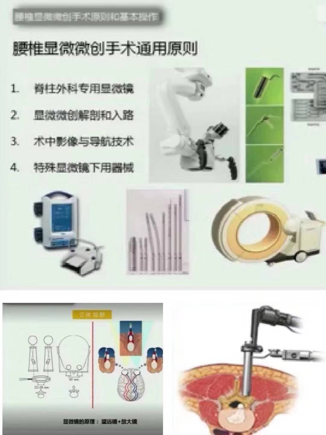 牙齿不好引发的疾病视频,牙齿有问题不做根管治疗会怎么样