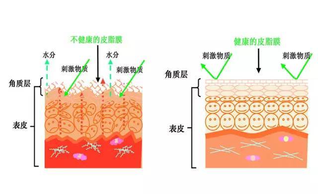 对于皮脂膜你有多少了解？
