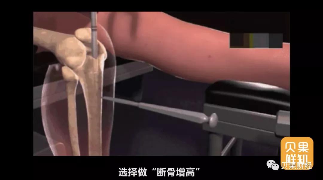 中国人30多年来越来越高,增高鞋垫却越卖越火,这到底是怎么了?